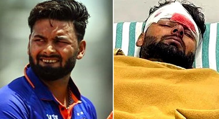 Rishabh Pant accident : मां को सरप्राइज देने किसी को बताए बिना देर रात निकल पड़े थे ऋषभ पंत, अब खतरे से बाहर, अनुपम खेर और अनिल कपूर मिलने पहुंचे